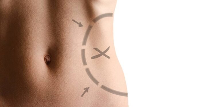 Erro comum antes da Lipo HD pode comprometer definição e recuperação - Créditos: depositphotos.com / ashumskiy