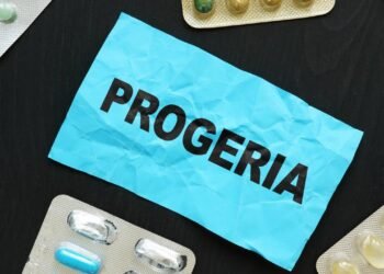 O distúrbio genético que transforma a infância em envelhecimento