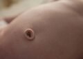 Cuidados com o coto umbilical: como limpar e evitar infecções nos primeiros dias