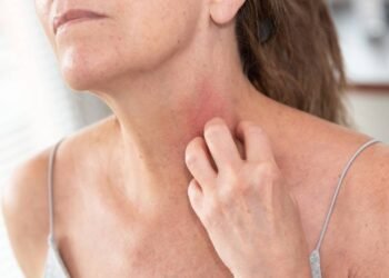 Alimentos certos podem reduzir coceira e fortalecer a pele com dermatite