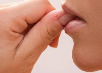 Roer unhas pode causar infecções dolorosas e desgastar os dentes