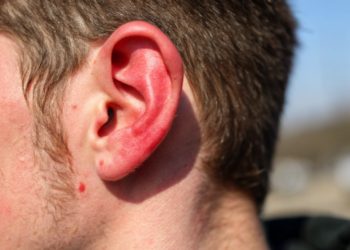 O que significa quando o seu olho treme ou a orelha esquenta