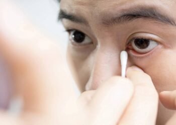 Quando a remela deixa de ser normal e merece atenção