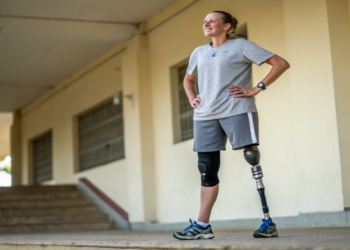 Próteses avançadas já permitem movimentos quase sobre-humanos e mudam o conceito de corpo humano