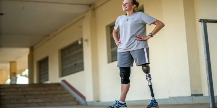Próteses avançadas já permitem movimentos quase sobre-humanos e mudam o conceito de corpo humano