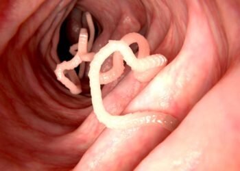 Como saber se você está com tênia? Veja os sinais