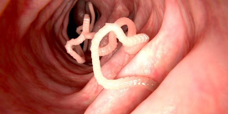 Dor abdominal e perda de peso podem indicar teníase? - Créditos: depositphotos.com / animaxx3d