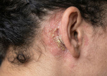 O que acontece quando você não limpa bem atrás das orelhas