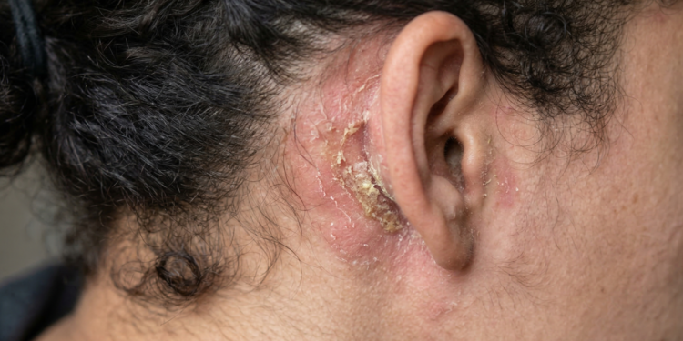 O que acontece quando você não limpa bem atrás das orelhas