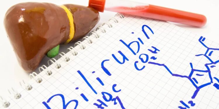 Urina escura pela manhã pode ser sinal de alerta -Créditos: depositphotos.com / Shidlovski