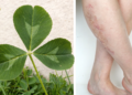 A folha natural que tem efeito diurético e ainda ajuda a reduzir o inchaço nas pernas