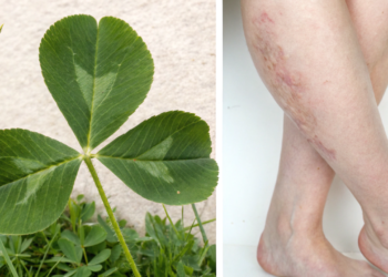 A folha natural que tem efeito diurético e ainda ajuda a reduzir o inchaço nas pernas