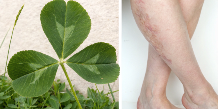 A folha natural que tem efeito diurético e ainda ajuda a reduzir o inchaço nas pernas