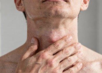 Sinais de que a tireoide não está funcionando corretamente