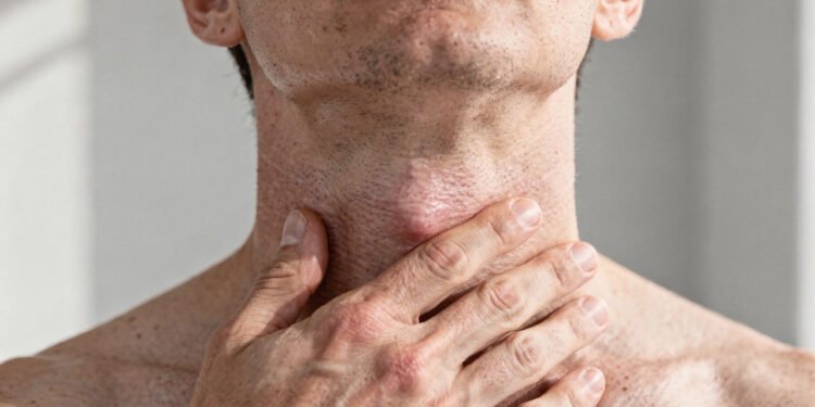 Sinais de que a tireoide não está funcionando corretamente