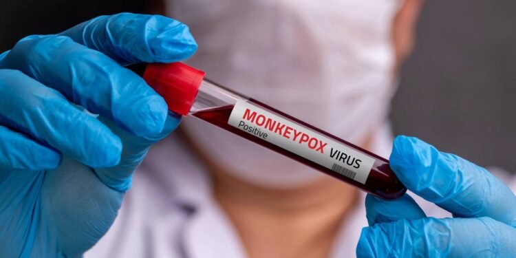 O alerta sobre mpox que explica transmissão e sinais da doença - Créditos: depositphotos.com / yalcinsonat1