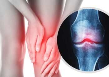 Exercícios podem ajudar a aliviar os sintomas da osteoartrite