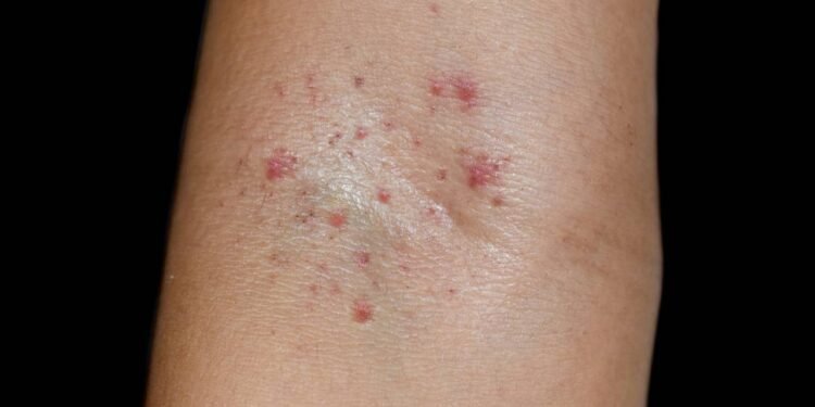 Pele pode revelar problema hepático antes de sintomas graves - Créditos: depositphotos.com / zaynyinyi