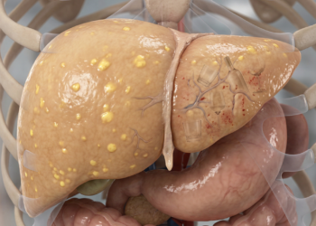 O que acontece com seu fígado quando você consome álcool regularmente, mesmo em pequenas quantidades