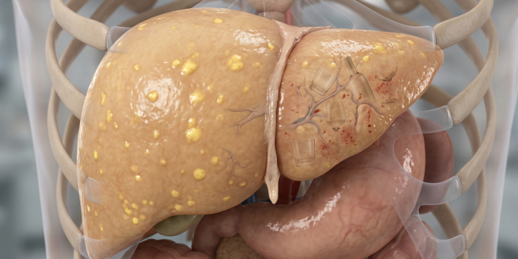 O que acontece com seu fígado quando você consome álcool regularmente, mesmo em pequenas quantidades