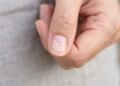 O que significa quando surgem manchas brancas nas unhas