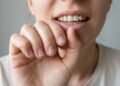 Roer unhas pode afetar a saúde bucal e desgastar os dentes: entenda os riscos e como parar