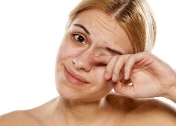 Alergia ocular causa coceira e vermelhidão mas remédios naturais podem aliviar rapidamente