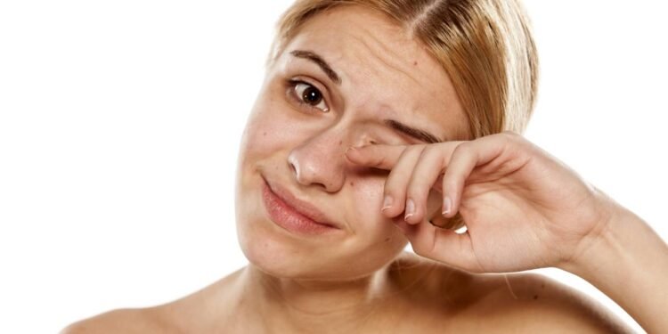 Remédios caseiros aliviam irritação nos olhos e reduzem vermelhidão de forma natural - Créditos: depositphotos.com / VGeorgiev