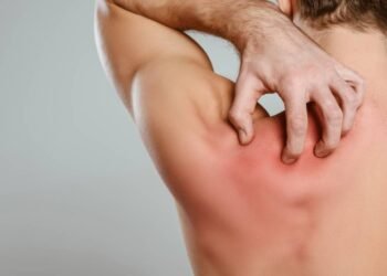 A coceira crônica nas costas pode não ser alergia e sim um alerta neurológico importante