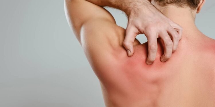 A coceira crônica nas costas pode não ser alergia e sim um alerta neurológico importante - Créditos: depositphotos.com / IgorVetushko