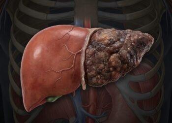 Como identificar sinais de sobrecarga no fígado antes que problemas mais sérios apareçam
