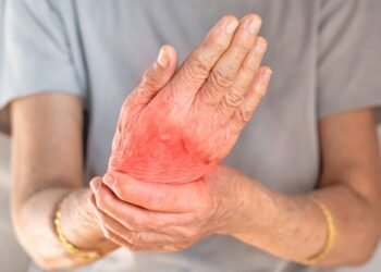 O motivo do inchaço ao acordar que pode não estar nos rins