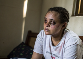 O que o corpo começa a mostrar quando os níveis de vitamina D estão baixos