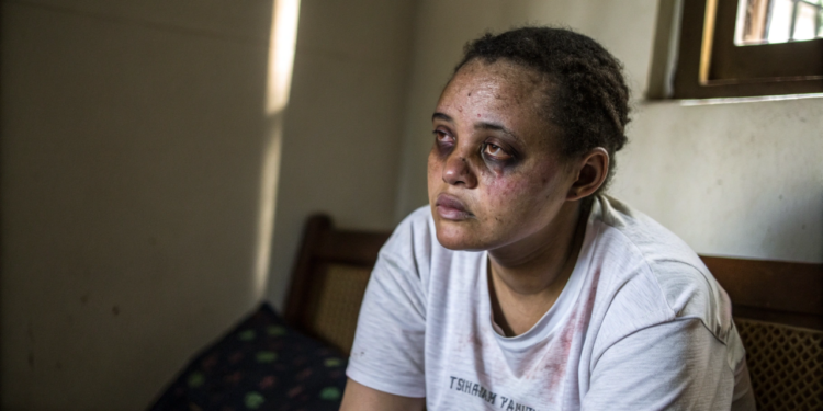 O que o corpo começa a mostrar quando os níveis de vitamina D estão baixos