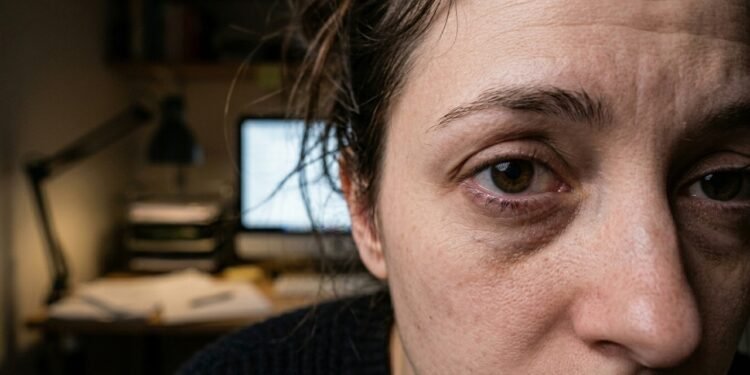 O tremor involuntário nas pálpebras não é sinal de derrames: neurologistas revelam o alerta silencioso de estresse e cansaço