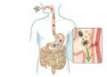 A semente que ajuda o intestino a funcionar melhor e ainda contribui para controlar o colesterol