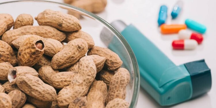 O consumo moderado dessa oleaginosa saborosa atua diretamente na proteção das artérias coronárias de forma totalmente natural e eficiente. - Créditos: depositphotos.com / AndrewLozovyi
