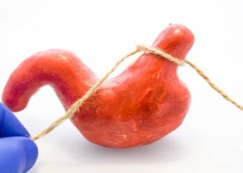 O que a obesidade faz no coração e na saúde emocional antes da bariátrica