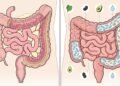 Como melhorar a saúde intestinal com 8 hábitos diários simples