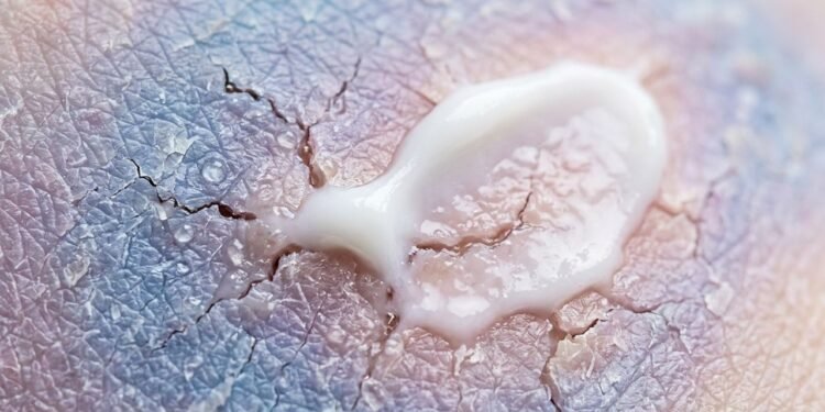 Angela Tewari, dermatologista: “O Cicaplast Baume B5 da La Roche-Posay não deve ser considerado um creme hidratante comum de uso diário, mas sim um bálsamo de reparação intensiva para a barreira cutânea danificada.”