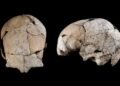 Enterrado por 5 mil anos sob uma tumba na Idade da Pedra, um crânio descoberto na Espanha revelou uma cirurgia de ouvido mais antiga do mundo