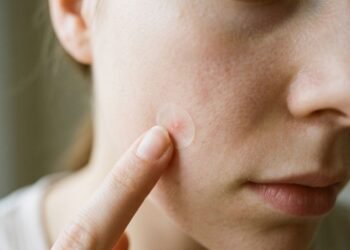 A dermatologista Dra. Ophelia Veraitch afirma: “Esfoliar demais a pele pode causar maior produção de óleo, descamação, pigmentação e até mesmo piorar a acne “