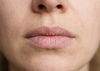Hidratante labial caseiro protege os lábios ressecados