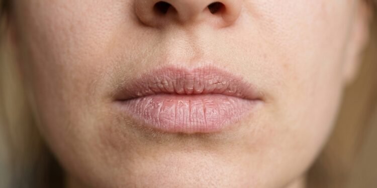 Hidratante labial caseiro protege os lábios ressecados