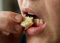 Colocar alho amassado direto na gengiva para aliviar dor de dente: o alerta dos dentistas sobre o perigo real de queimadura química na boca