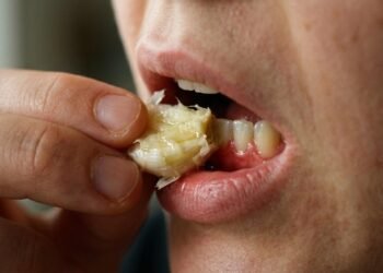 Colocar alho amassado direto na gengiva para aliviar dor de dente: o alerta dos dentistas sobre o perigo real de queimadura química na boca