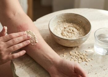Aplicar pasta de aveia com água sobre a pele irritada: como as substâncias calmantes diminuem a coceira de picadas de insetos e alergias