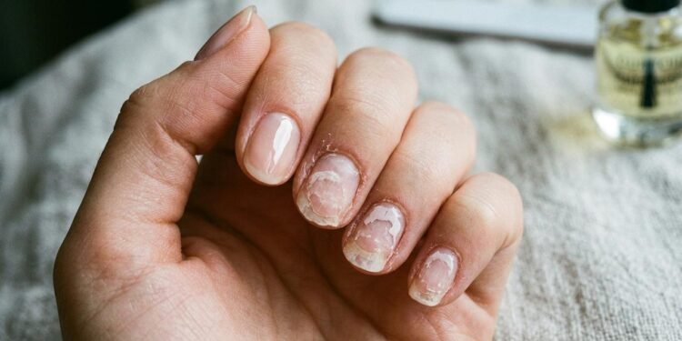 Diferentemente do esmalte tradicional, o esmalte em gel precisa passar por um processo de endurecimento com uma lâmpada específica.