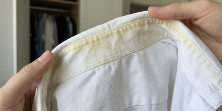 roupas amarelam no armário