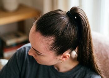 Cabelo preso todos os dias: especialistas explicam o limite entre um penteado comum e a tensão que pode causar danos
